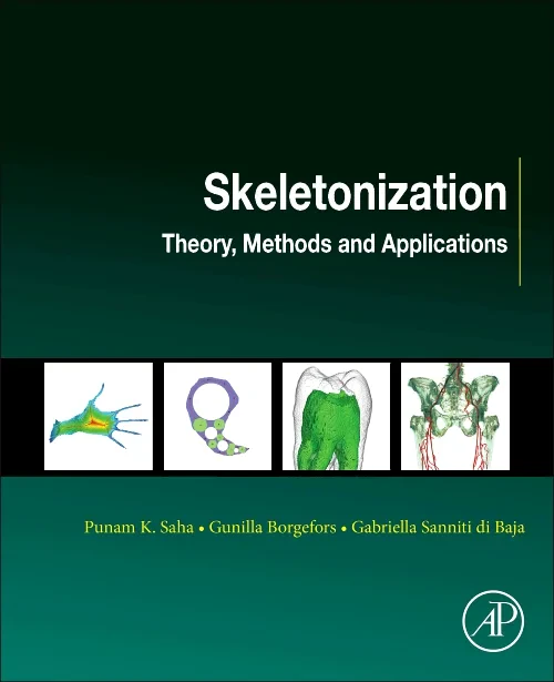 Coperta cărții "Skeletonization" de autor necunoscut