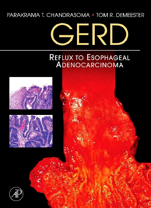 Coperta cărții "GERD" de autor necunoscut