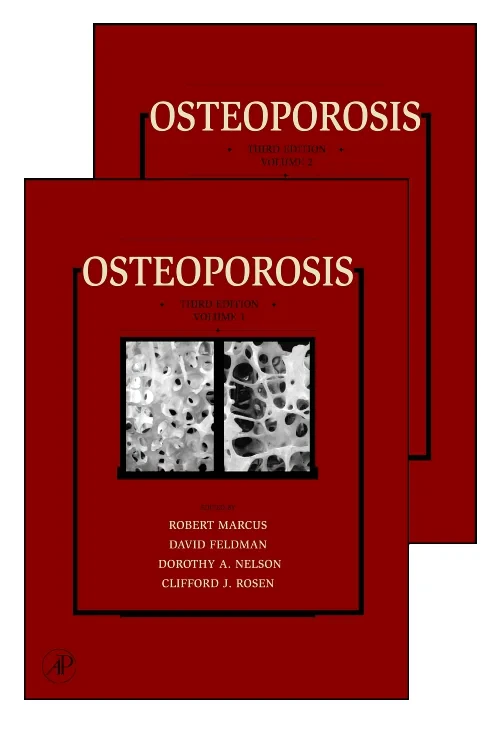 Coperta cărții "Osteoporosis" de autor necunoscut