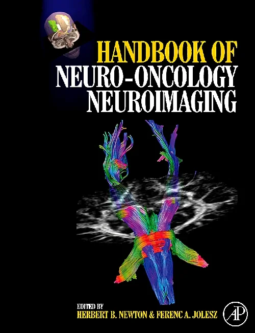 Coperta cărții "Handbook of Neuro-Oncology Neuroimaging" de autor necunoscut