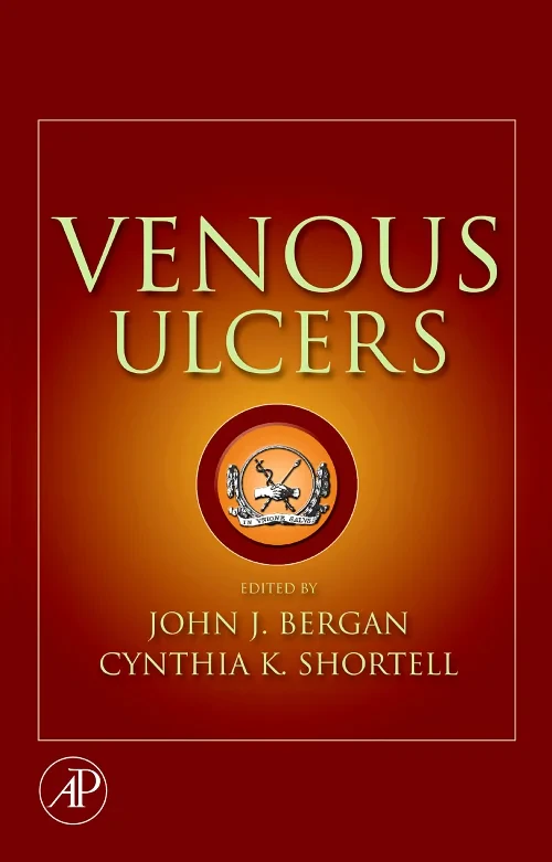 Coperta cărții "Venous Ulcers" de autor necunoscut