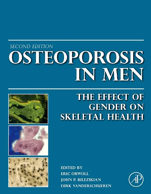 Coperta cărții "Osteoporosis in Men" de autor necunoscut