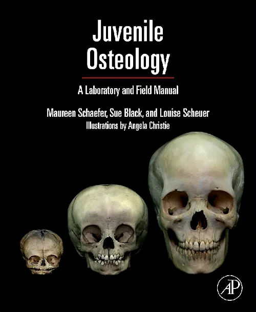 Coperta cărții "Juvenile Osteology" de autor necunoscut
