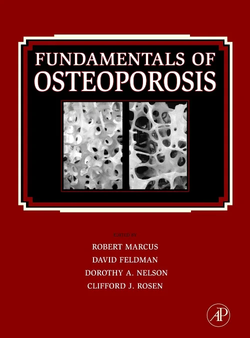 Coperta cărții "Fundamentals of Osteoporosis" de autor necunoscut