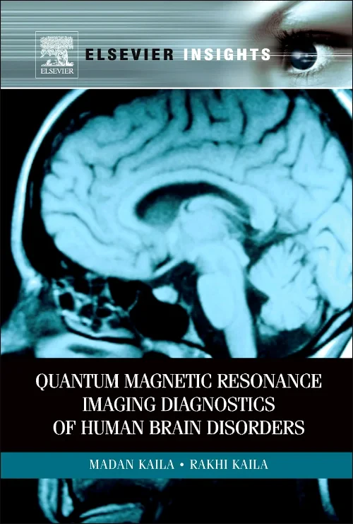 Coperta cărții "Quantum Magnetic Resonance Imaging Diagnostics of Human Brain Disorders" de autor necunoscut