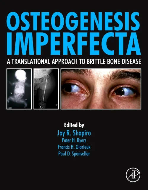 Coperta cărții "Osteogenesis Imperfecta" de autor necunoscut