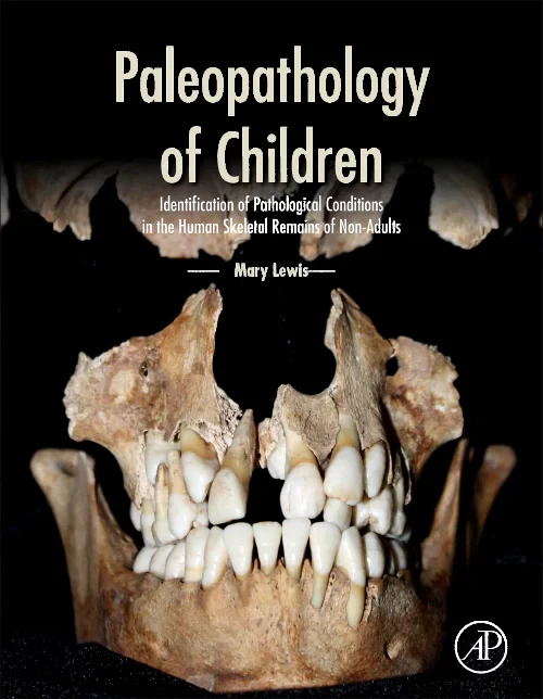 Coperta cărții "Paleopathology of Children" de autor necunoscut