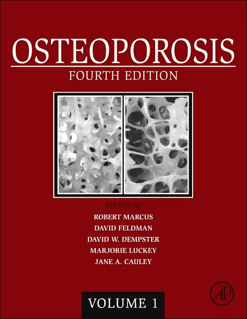 Coperta cărții "Osteoporosis" de autor necunoscut