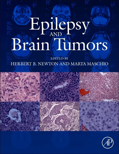 Coperta cărții "Epilepsy and Brain Tumors" de autor necunoscut