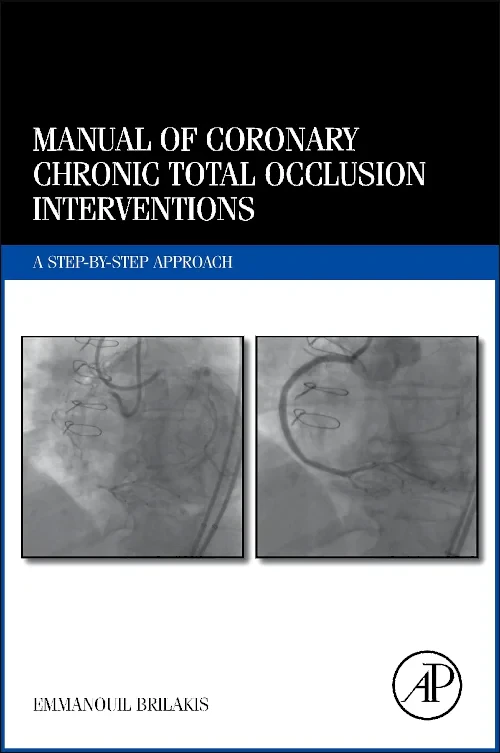Coperta cărții "Manual of Coronary Chronic Total Occlusion Interventions" de autor necunoscut
