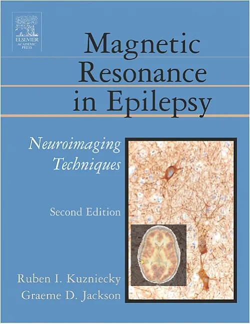 Coperta cărții "Magnetic Resonance in Epilepsy" de autor necunoscut