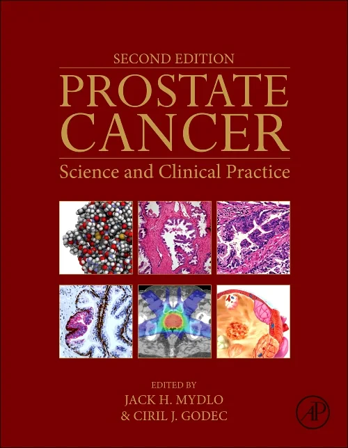 Coperta cărții "Prostate Cancer" de autor necunoscut