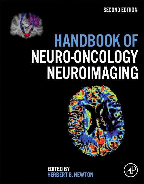 Coperta cărții "Handbook of Neuro-Oncology Neuroimaging" de autor necunoscut