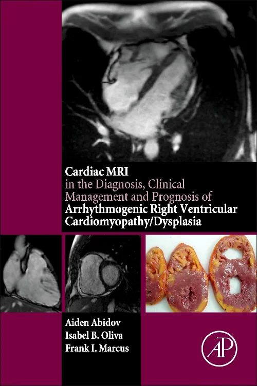 Coperta cărții "Cardiac MRI in Diagnosis, Clinical Management, and Prognosis of Arrhythmogenic Right Ventricular Cardiomyopathy/Dysplasia" de autor necunoscut