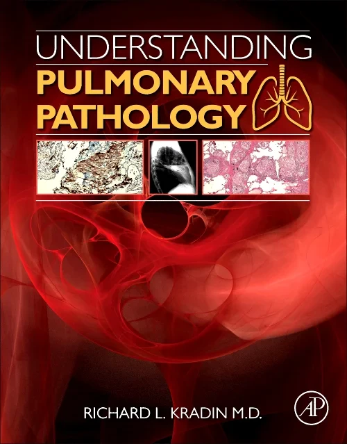 Coperta cărții "Understanding Pulmonary Pathology" de autor necunoscut