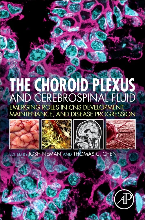 Coperta cărții "The Choroid Plexus and Cerebrospinal Fluid" de autor necunoscut