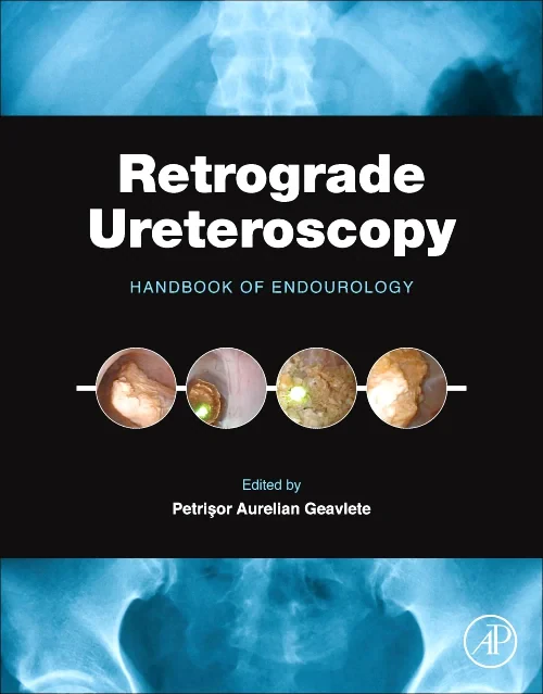 Coperta cărții "Retrograde Ureteroscopy" de autor necunoscut