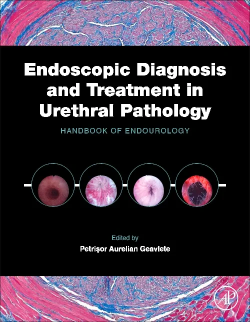 Coperta cărții "Endoscopic Diagnosis and Treatment in Urethral Pathology" de autor necunoscut