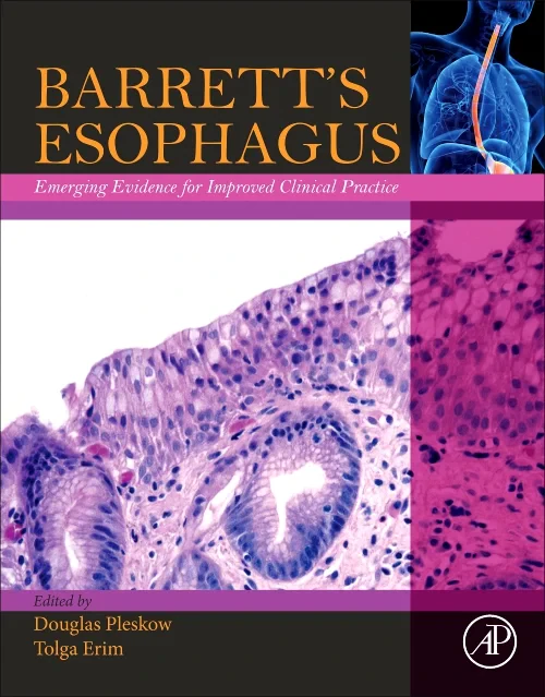 Coperta cărții "Barrett’s Esophagus" de autor necunoscut