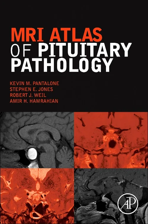 Coperta cărții "MRI Atlas of Pituitary Pathology" de autor necunoscut