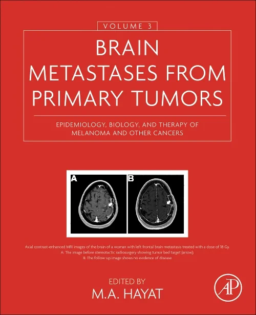 Coperta cărții "Brain Metastases from Primary Tumors, Volume 3" de autor necunoscut