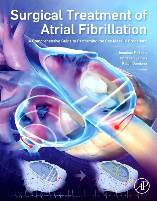 Coperta cărții "Surgical Treatment of Atrial Fibrillation" de autor necunoscut