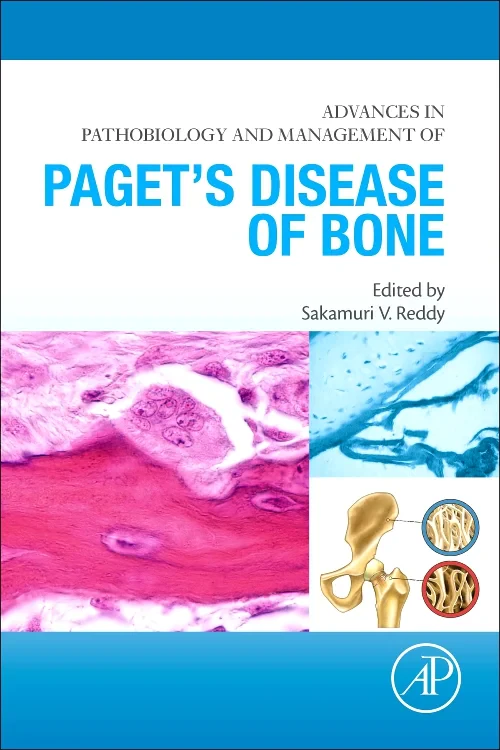 Coperta cărții "Advances in Pathobiology and Management of Paget’s Disease of Bone" de autor necunoscut