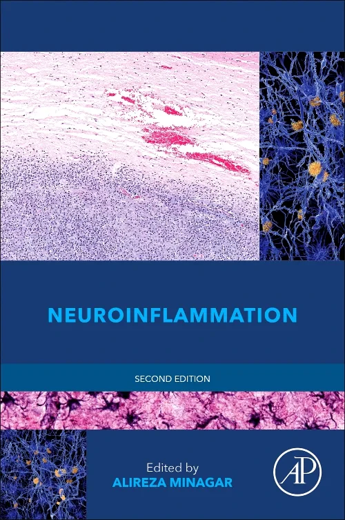 Coperta cărții "Neuroinflammation" de autor necunoscut