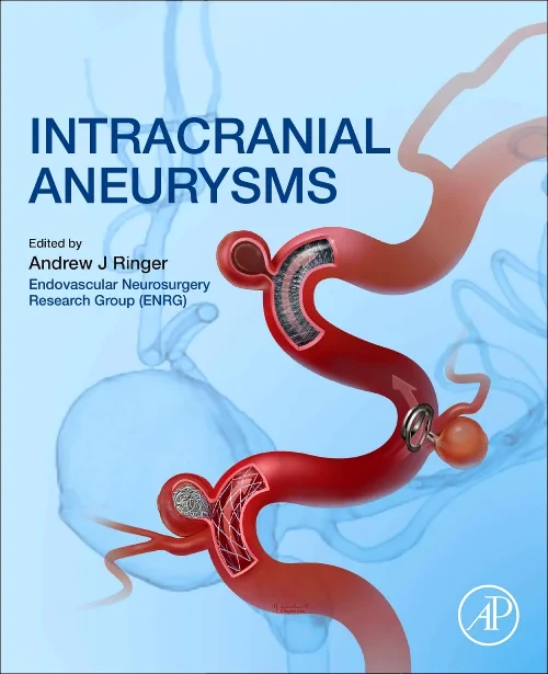 Coperta cărții "Intracranial Aneurysms" de autor necunoscut