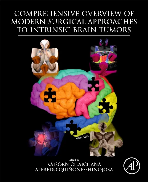 Coperta cărții "Comprehensive Overview of Modern Surgical Approaches to Intrinsic Brain Tumors" de autor necunoscut