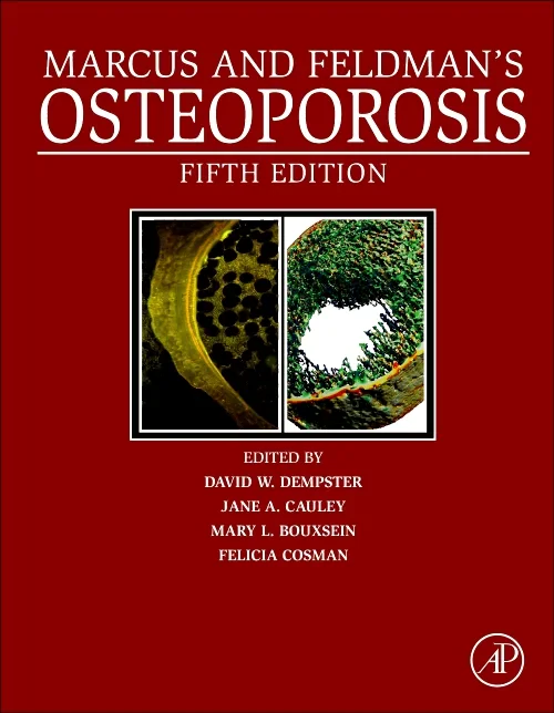 Coperta cărții "Marcus and Feldman&#039;s Osteoporosis" de autor necunoscut