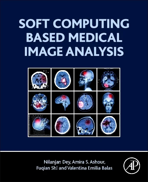 Coperta cărții "Soft Computing Based Medical Image Analysis" de autor necunoscut
