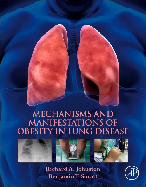 Coperta cărții "Mechanisms and Manifestations of Obesity in Lung Disease" de autor necunoscut