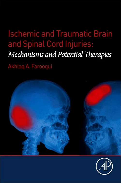Coperta cărții "Ischemic and Traumatic Brain and Spinal Cord Injuries" de autor necunoscut