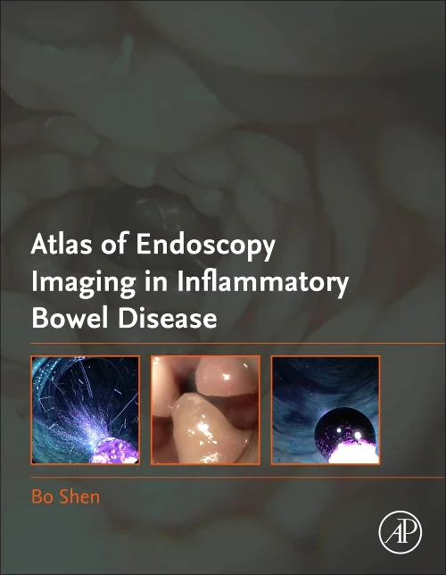 Coperta cărții "Atlas of Endoscopy Imaging in Inflammatory Bowel Disease" de autor necunoscut