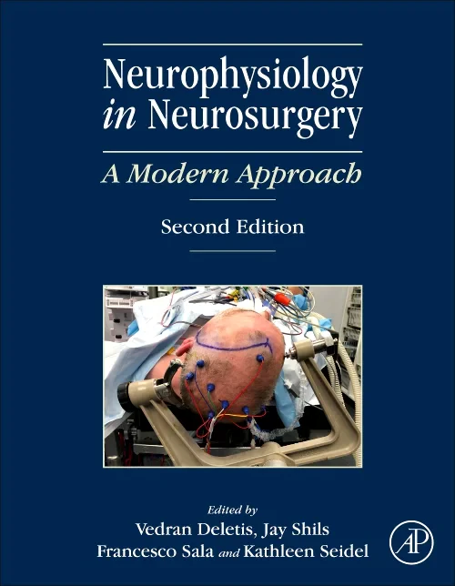 Coperta cărții "Neurophysiology in Neurosurgery" de autor necunoscut