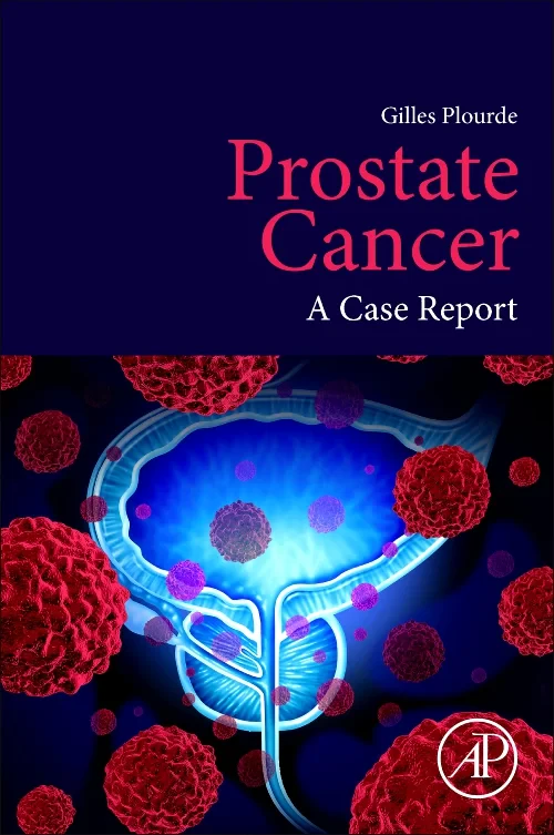 Coperta cărții "Prostate Cancer" de autor necunoscut