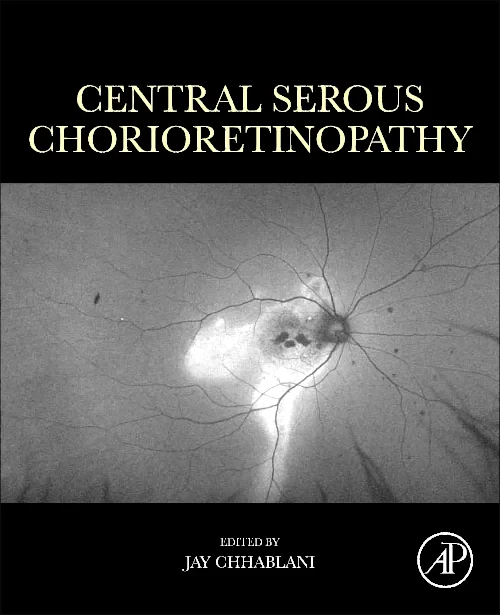 Coperta cărții "Central Serous Chorioretinopathy" de autor necunoscut