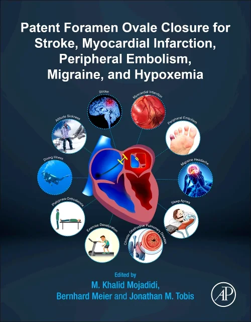 Coperta cărții "Patent Foramen Ovale Closure for Stroke, Myocardial Infarction, Peripheral Embolism, Migraine, and Hypoxemia" de autor necunoscut