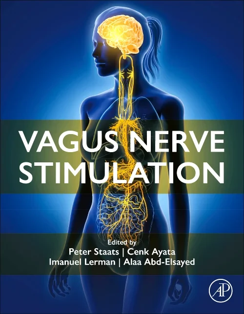 Coperta cărții "Vagus Nerve Stimulation" de autor necunoscut