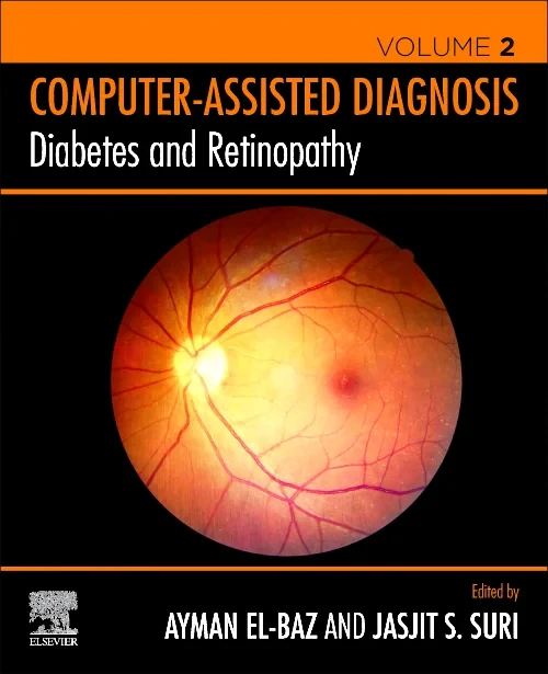 Coperta cărții "Diabetes and Retinopathy" de autor necunoscut