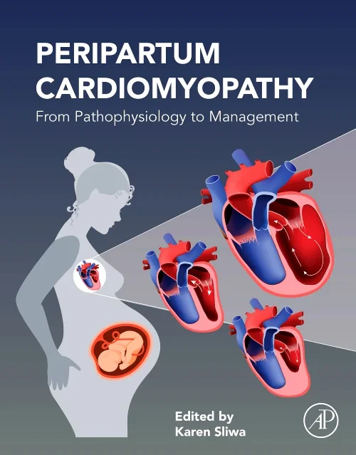Coperta cărții "Peripartum Cardiomyopathy" de autor necunoscut