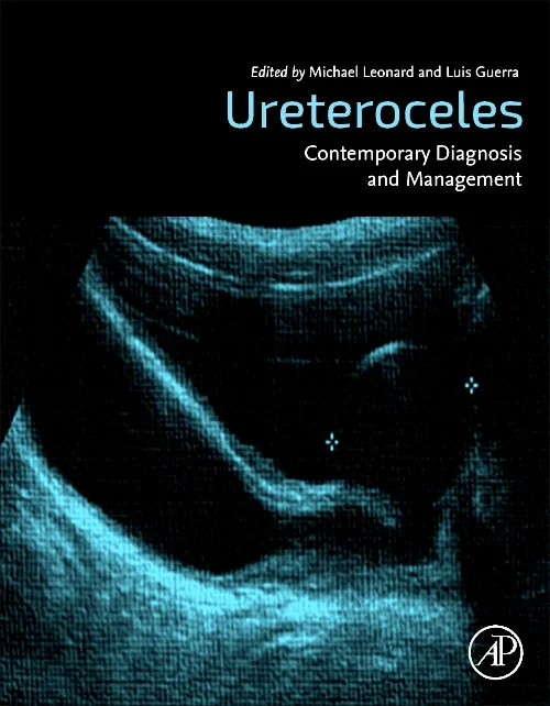 Coperta cărții "Ureteroceles" de autor necunoscut