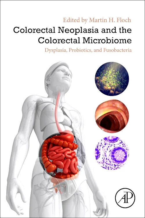 Coperta cărții "Colorectal Neoplasia and the Colorectal Microbiome" de autor necunoscut