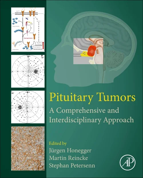Coperta cărții "Pituitary Tumors" de autor necunoscut