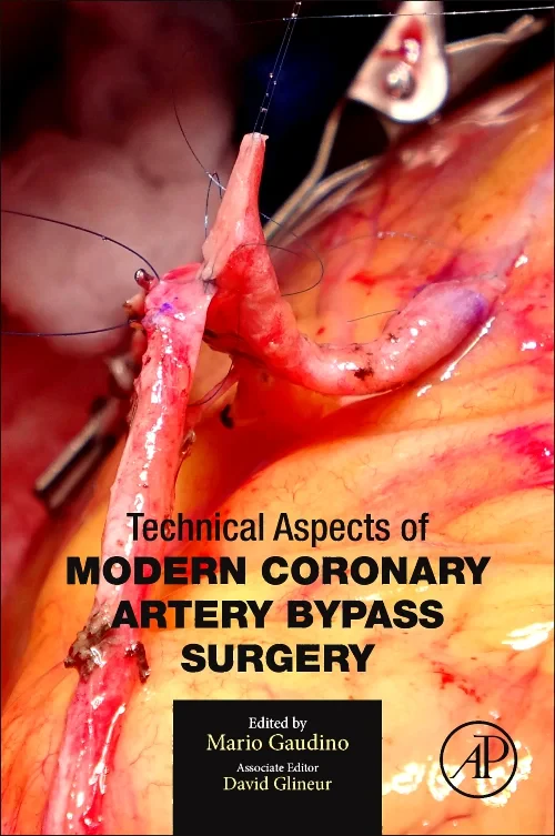 Coperta cărții "Technical Aspects of Modern Coronary Artery Bypass Surgery" de autor necunoscut