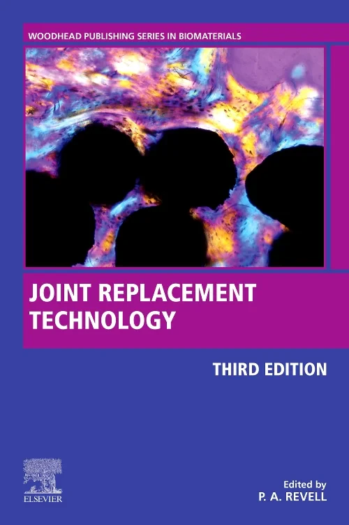 Coperta cărții "Joint Replacement Technology" de autor necunoscut