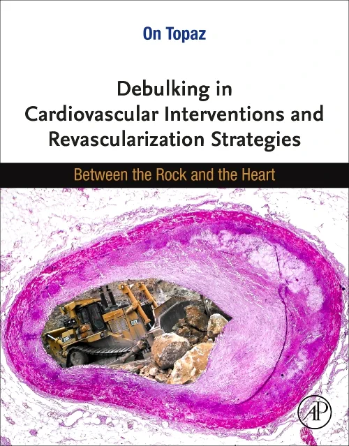 Coperta cărții "Debulking in Cardiovascular Interventions and Revascularization Strategies" de autor necunoscut