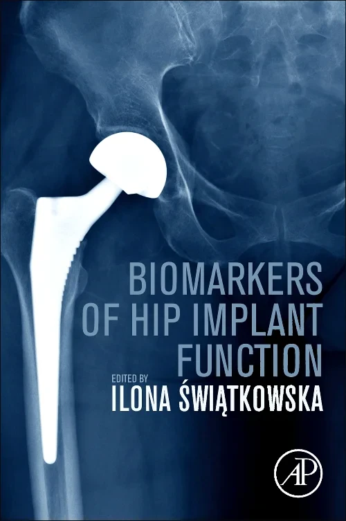 Coperta cărții "Biomarkers of Hip Implant Function" de autor necunoscut