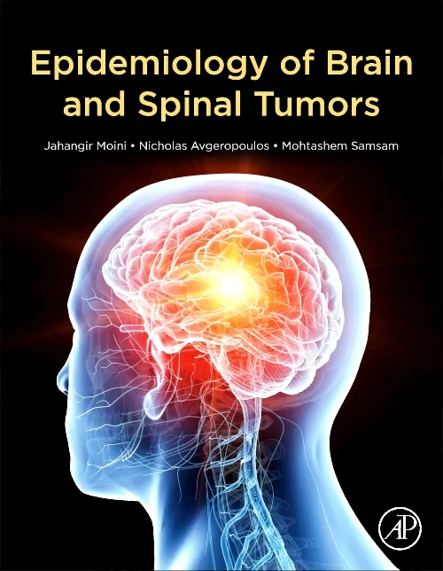 Coperta cărții "Epidemiology of Brain and Spinal Tumors" de autor necunoscut